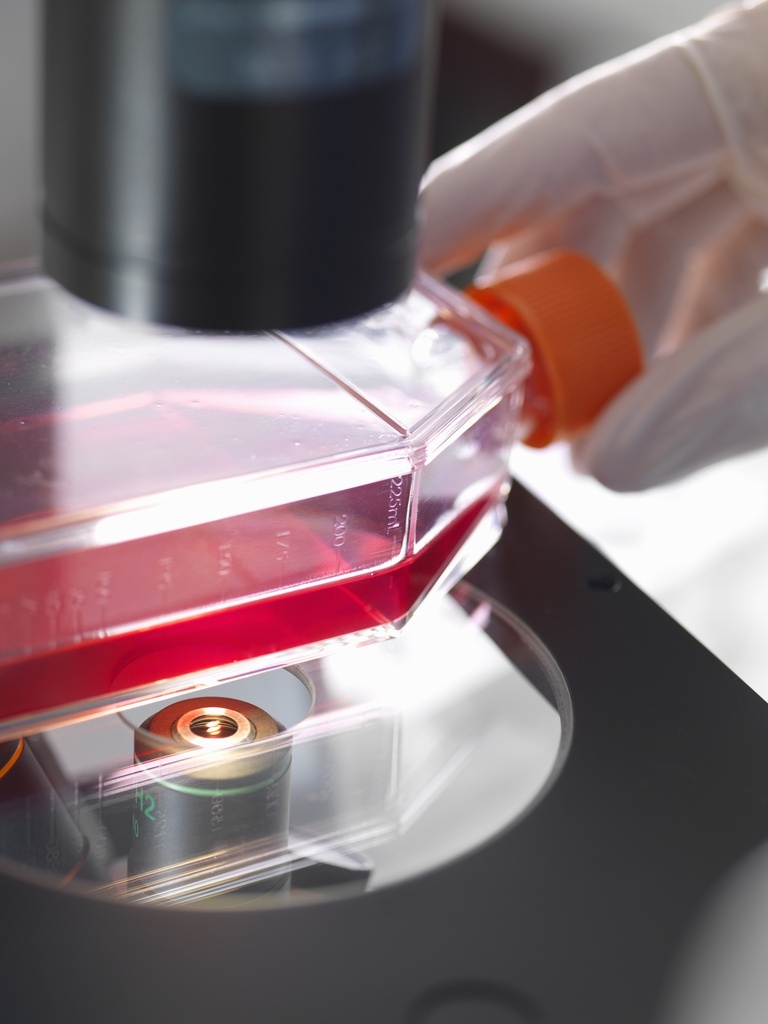 [ASTPLATE-SA2-131] Red Fluorescent Immortalized Human Umbilical Vein Endothelial Cells (HUVEC+RFP)