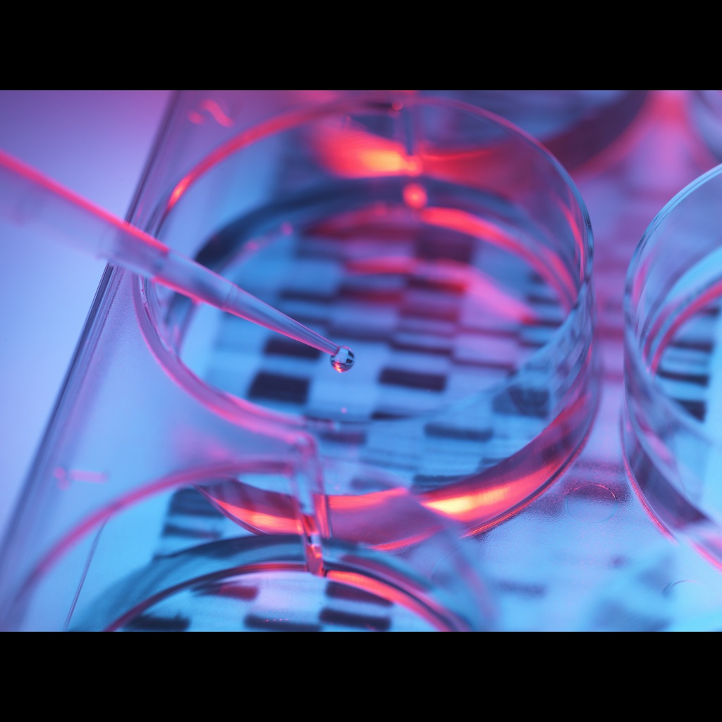 [0556-MBC070-R] Amplirun® Streptococcus Pneumoniae DNA Control size: 10,000size:20,000 c/µL