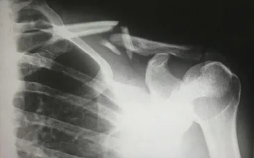 Single-Cell RNA Sequencing in Bone Research
